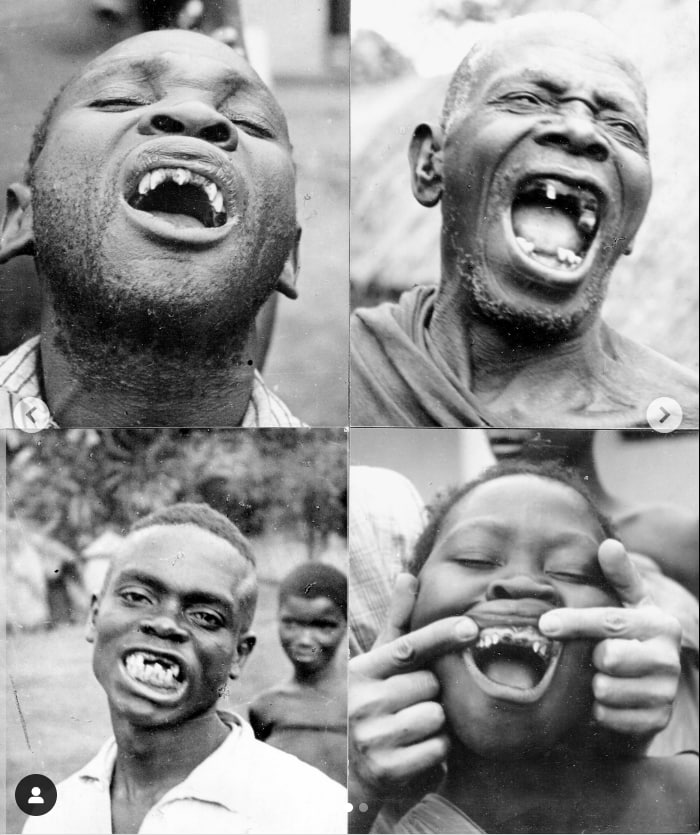 Patru portrete alb-negru ale uor bărbati africani tcare râd, cu dinți vizibili și dantură nesănătoasă. Fotografii de Weston A. Price
