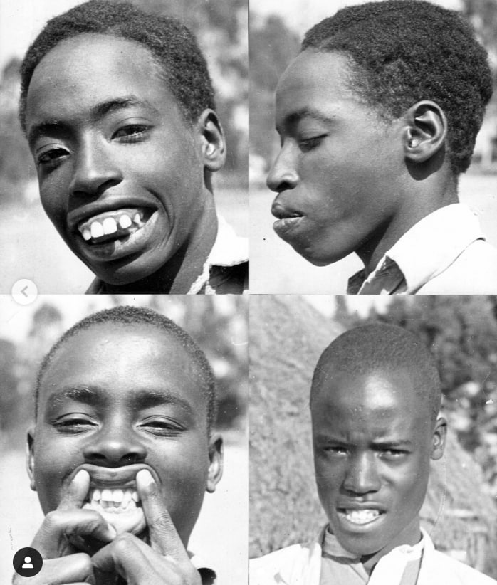 Patru portrete alb-negru ale unor tineri africani, cu dinți vizibili și dantură încălecată. Fotografii de Weston A. Price